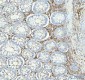 Anti-ACAA2 Rabbit Monoclonal Antibody
